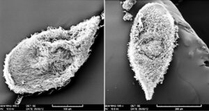 enlarged view of microscopic creatures